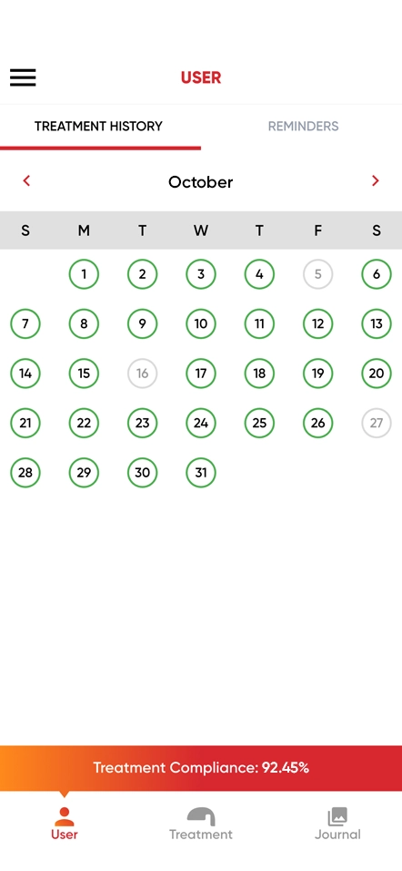 REVIAN app showing treatment history, a monthly calendar, and treatment compliance